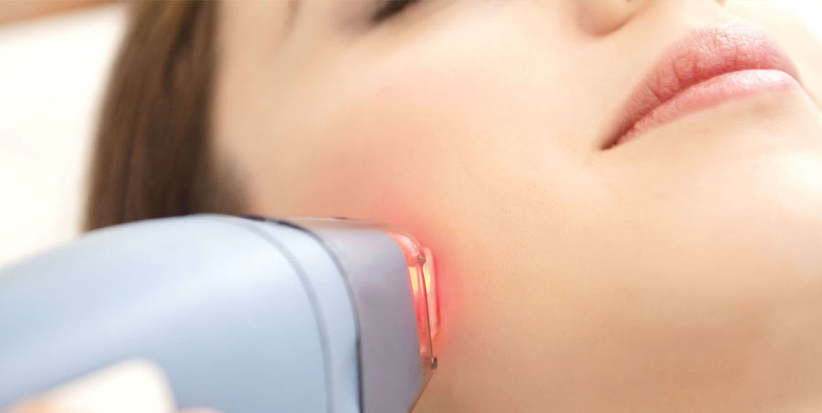 Informations sur les lasers en dermatologie Dr CADIC Philippe
